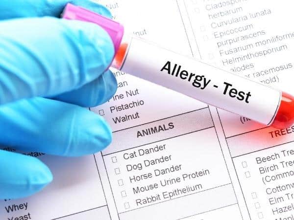 allergy test blood test